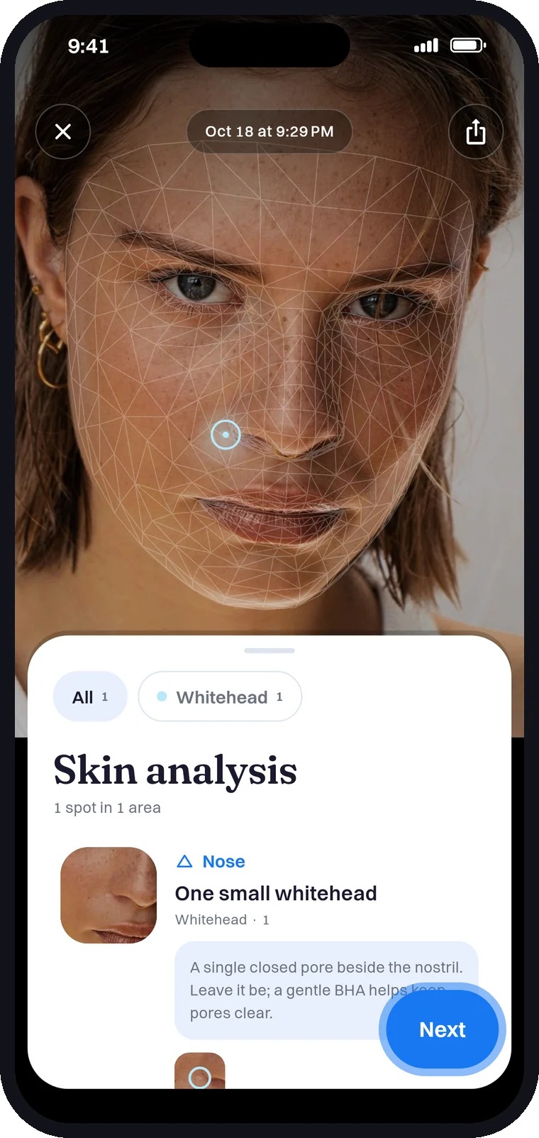 A scan result with the face mapped and one small whitehead marked beside the nostril.