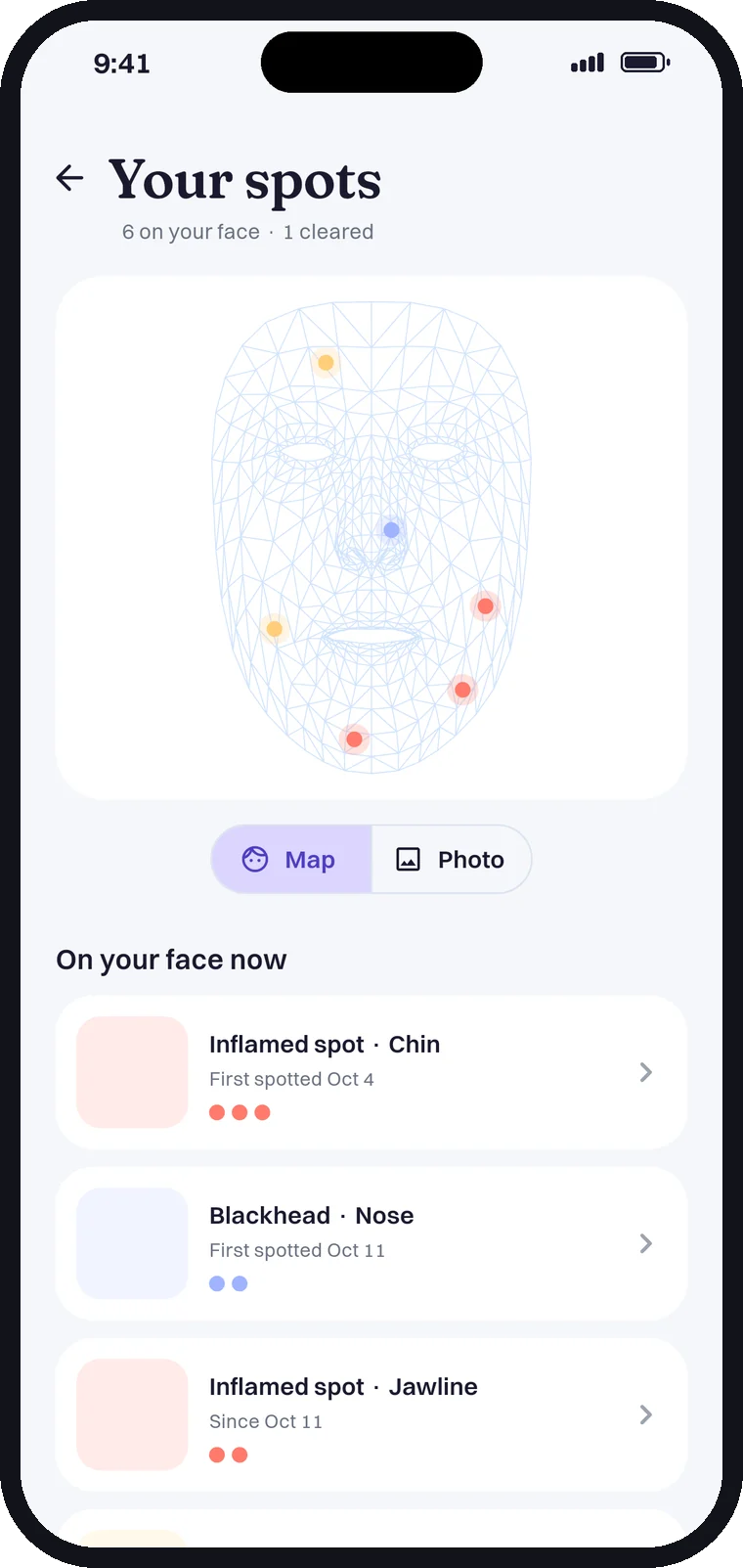 The spots page: a face map and the spots on your face now, with when each was first spotted.